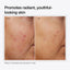 Niacinamide 10% + Zinc 1%