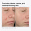 Salicylic Acid 2% Solution